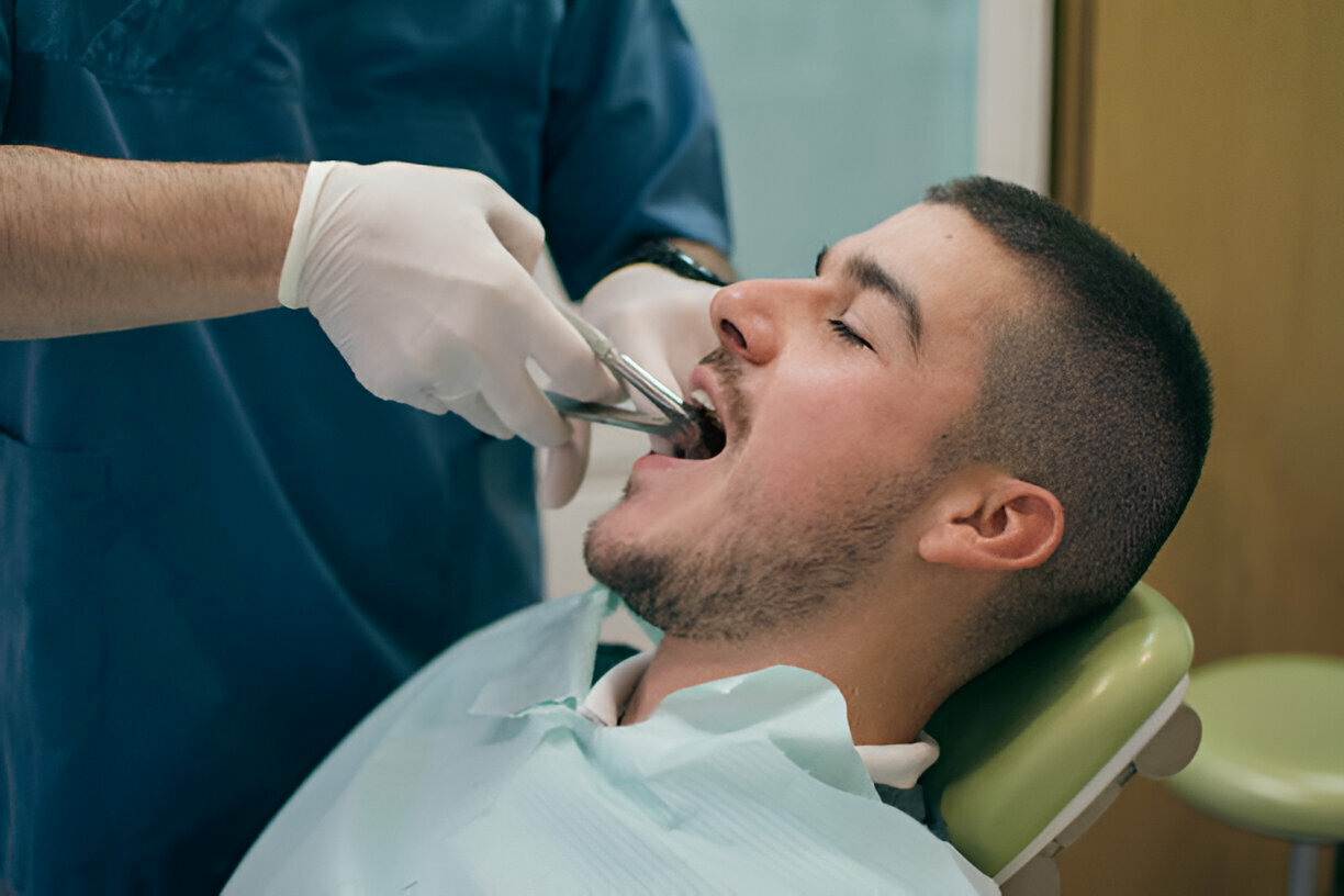 How to Find the Right Dentist for Your Tooth Extraction