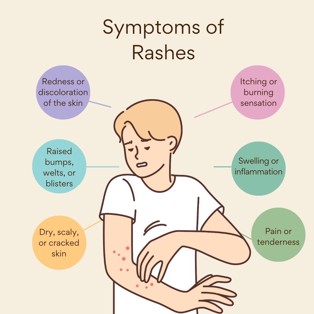 Rash: Common Skin Rashes, Causes, and Treatment